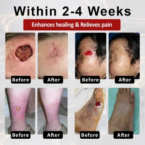 ALISANDA® GlucoseGuard Skin Rescue Cream