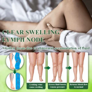 ATTDX® HerbalDrain Edema Comfort Massage Cream