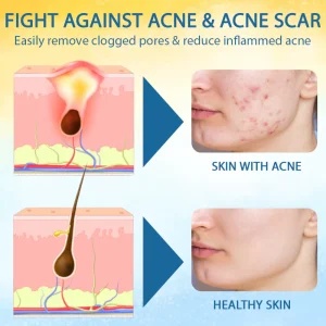 Cvreoz® PsoriasisCare Mellifera Venom Skin Healing Spray