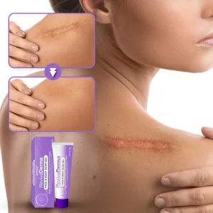 ATTDX® RevivaDerma Face & Body Scar Gel