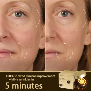 ODEIUN™ Anti-Aging Cream – Hyaluronic Acid, Retinol & Collagen for Face, Neck
