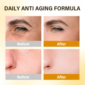 ODEIUN™ Anti-Aging Cream – Hyaluronic Acid, Retinol & Collagen for Face, Neck