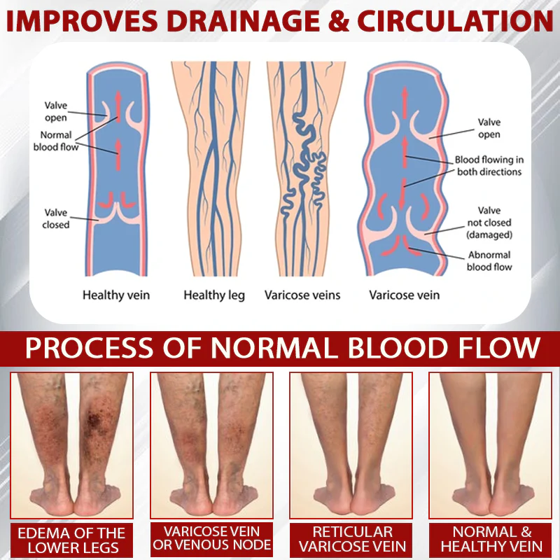 ATTDX® Advanced CVI Edema Therapy Cream 7 ATTDX® Advanced CVI Edema Therapy Cream