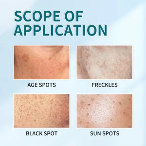 Bikenda™ Blemish Removing Beauty Cream 24 Bikenda™ Blemish Removing Beauty Cream