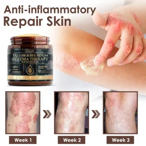 Zvoevo® Tallow Bee Venom Skin Restoration Cream