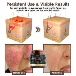 Zvoevo® Tallow Bee Venom Skin Restoration Cream