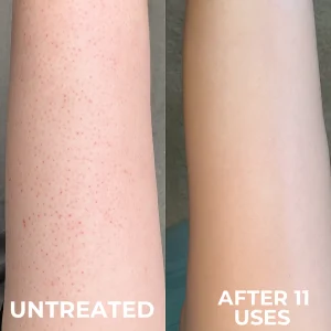 Blenada Berry - Strawberry Skin Smoother