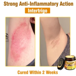 LOVILDS™ Bee Poison All-in-One Cream