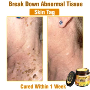 LOVILDS™ Bee Poison All-in-One Cream