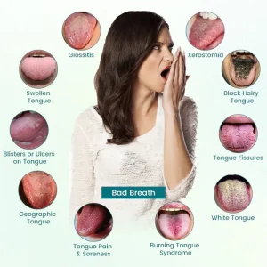 Oveallgo® GlosShield Tongue Repair Spray