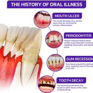 Cougex® VioGloss Bee Venom Dental Therapy Oral Power